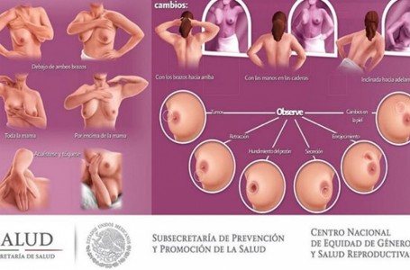 Cáncer de mama: nuevas recomendaciones sobre mamografías