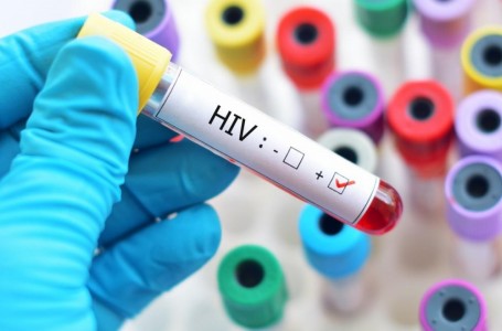 Expertos lograron curar a un paciente con VIH por segunda vez en la historia